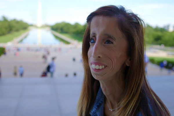 Lizzie Velasquez in A Brave Heart: The Lizzie Velasquez Story, distributed by Cinedigm.